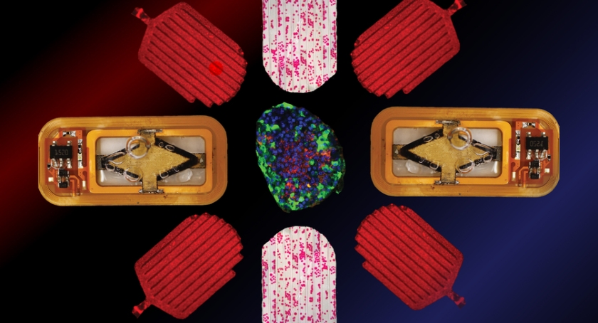 Cell Implant Device Could Control Type 1 Diabetes